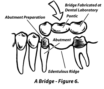 Large Image of Medical Illustration Sample