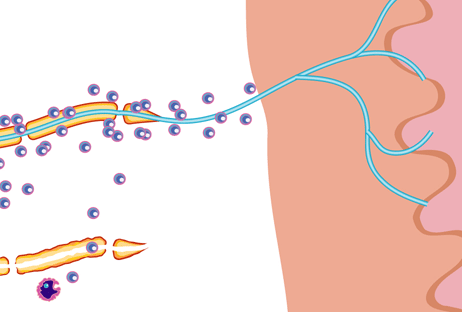 Large Image of Medical Illustration Sample