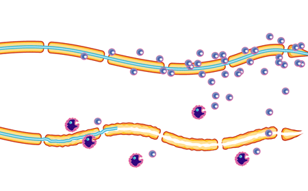 Large Image of Medical Illustration Sample
