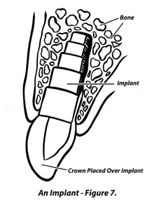 Large Image of Medical Illustration Sample