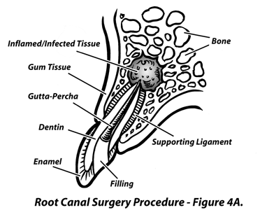 Large Image of Medical Illustration Sample