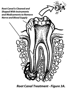 Large Image of Medical Illustration Sample