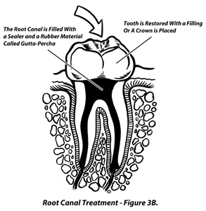 Large Image of Medical Illustration Sample