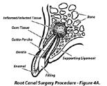 Medical Scientific Illustration Sample
